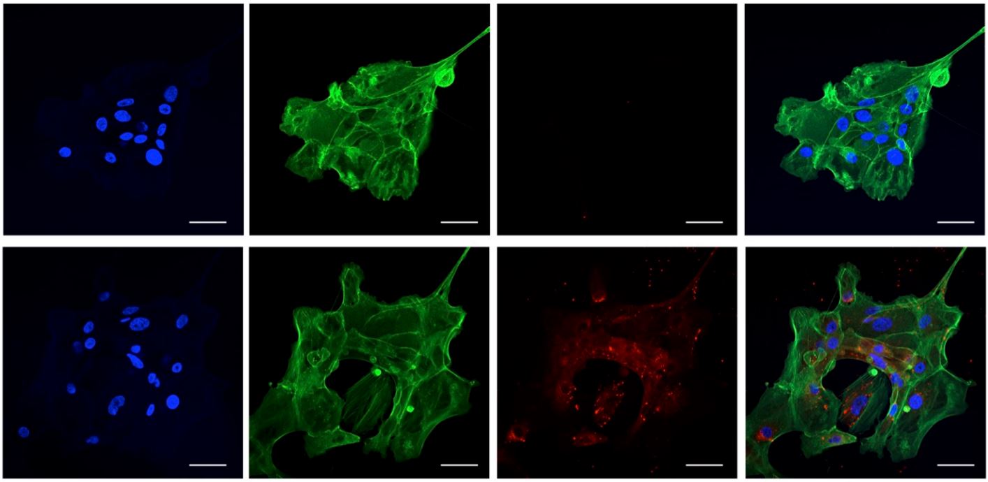 Enrichissement et caractÃ©risation des exosomes de la cornÃ©e humaine