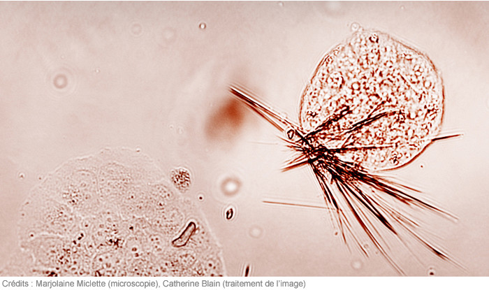 #MagAcfas - Découvrir : Déjouer le cancer du sein, par Marjolaine Miclette, INRS - Institut Armand-Frappier