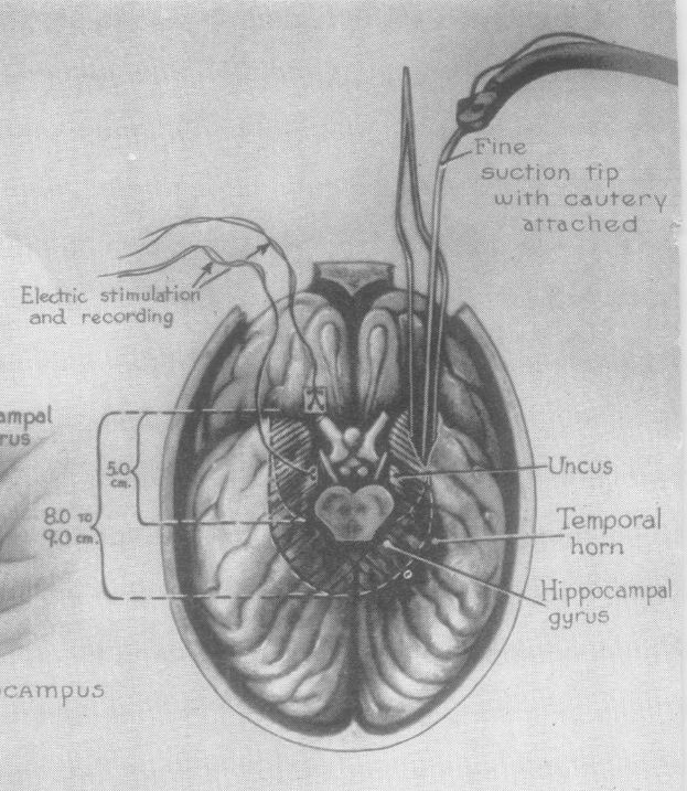 Dupont 9.2