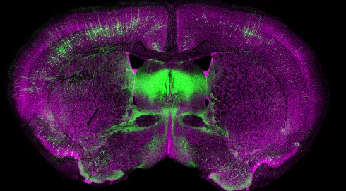 Panne de neurones moteurs?