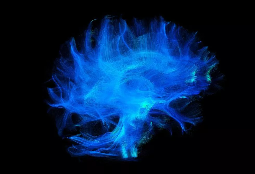 Image artistique d'un cerveau